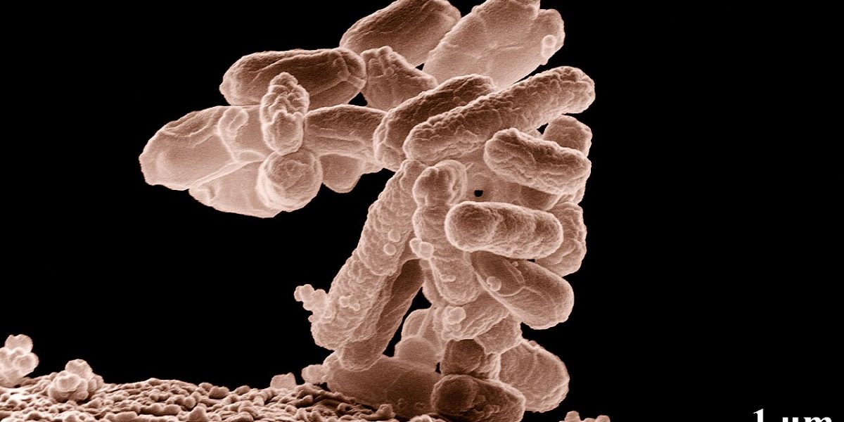 Microscope image of E. coli bacteria, a common indicator of faecal contamination in drinking water